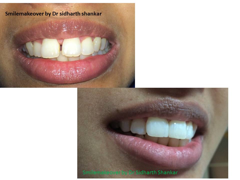 smilemakeover